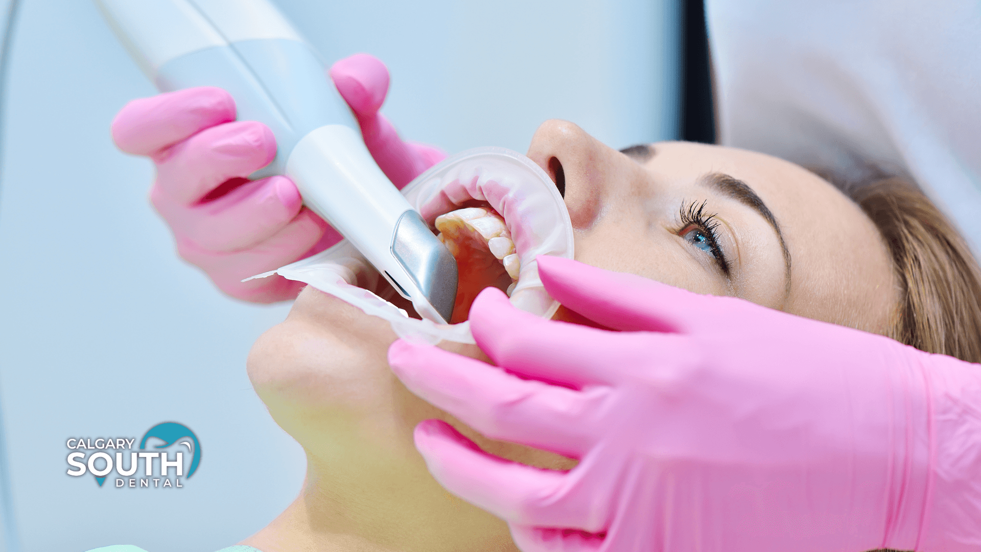 What You Should Know About Intraoral Scanners